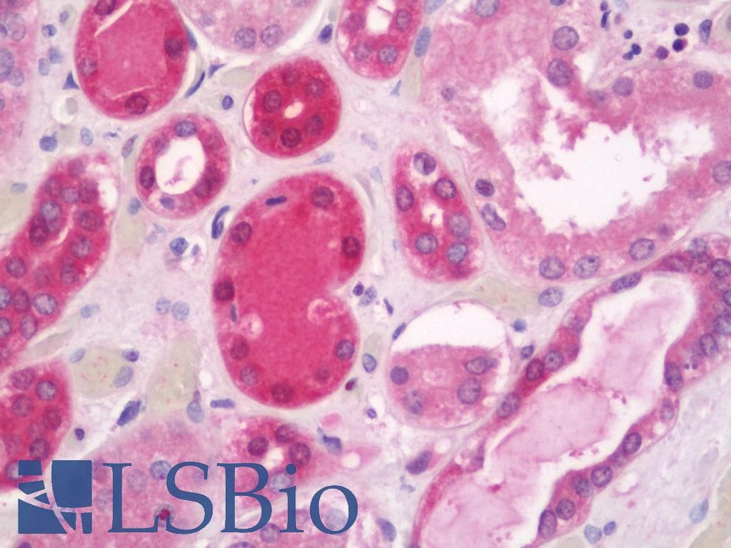 IHC-plus™ Polyclonal Rabbit anti-Human PSCA Antibody (aa41-90, IHC, WB)
