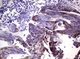 Monoclonal Mouse anti-Human HIF2A / EPAS1 Antibody (clone OTI2A6, aa584-870, IHC, WB)