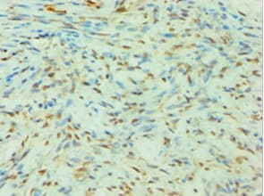 SLC4A2 / AE2 Antibody (aa95-245)