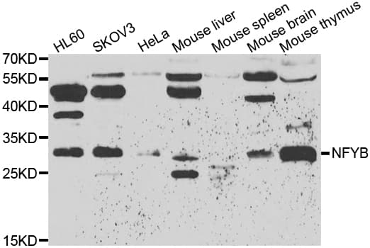 Polyclonal Rabbit anti-Human NFYB Antibody (IHC, IF, WB)