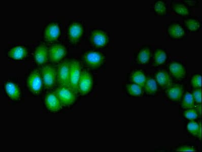 Polyclonal Rabbit anti-Human HUS1 Antibody (WB)
