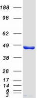 Human SSB / La Protein (Recombinant Myc-DDK (Flag))
