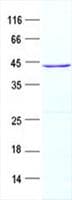 Human LEFTYB / LEFTY1 Protein (Recombinant His, N-Terminal)