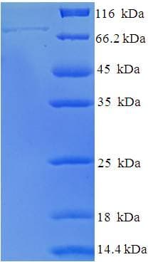 Human POLR3C Protein (Recombinant His-SUMO)