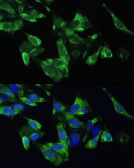 Polyclonal Rabbit anti-Human TMEPAI / PMEPA1 Antibody (IF, WB)
