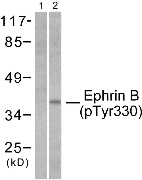 Polyclonal Rabbit anti-Human Ephrin B1+B2 Antibody (phospho-Tyr330, WB)