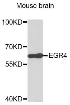Polyclonal Rabbit anti-Human EGR4 / EGR-4 Antibody (IHC, WB)