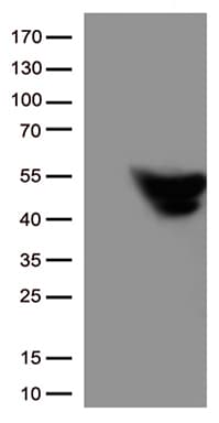 Monoclonal Mouse anti-Human GFAP Antibody (clone UMAB5, IHC, IF, WB)