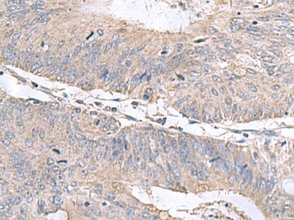 RNF208 Antibody