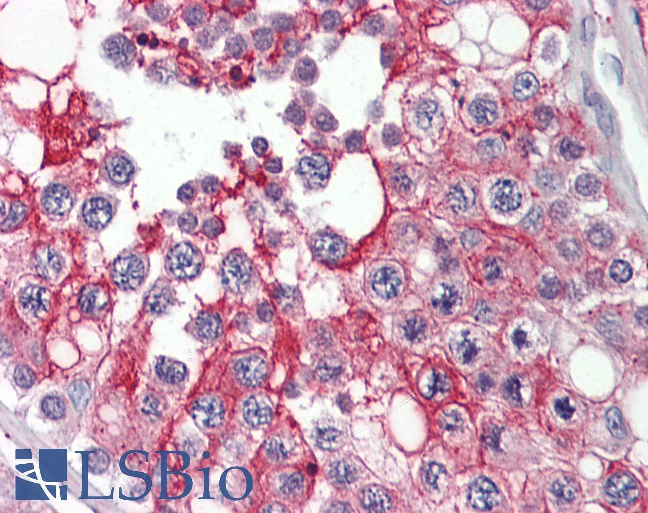 IHC-plus™ Polyclonal Rabbit anti-Human PIK3CG / PI3K Gamma Antibody (IHC, WB)