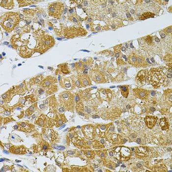 Polyclonal Rabbit anti-Human APG5 / ATG5 Antibody (IHC)