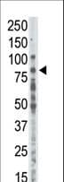 PRKCA / PKC-Alpha Antibody (aa299-329)