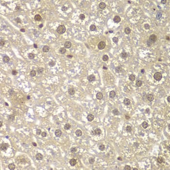 MAD1L1 / MAD1 Antibody
