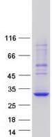 Human BCAS4 Protein (Recombinant Myc-DDK (Flag))