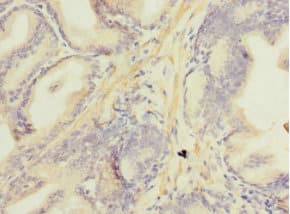 Polyclonal Rabbit anti-Human NDUFA13 / GRIM19 Antibody (IHC, WB)