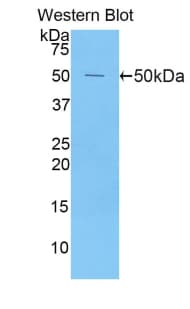 PRDX1 / Peroxiredoxin 1 Antibody (aa1-199)
