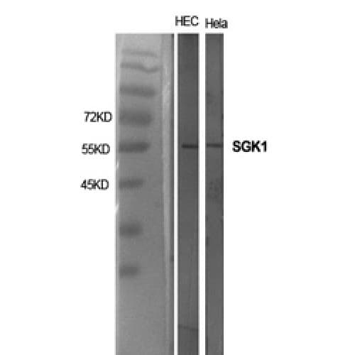 SGK1 / SGK Antibody (350-430 aa)