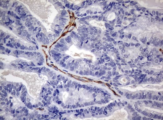 PECAM-1 / CD31 Antibody (clone UMAB32)
