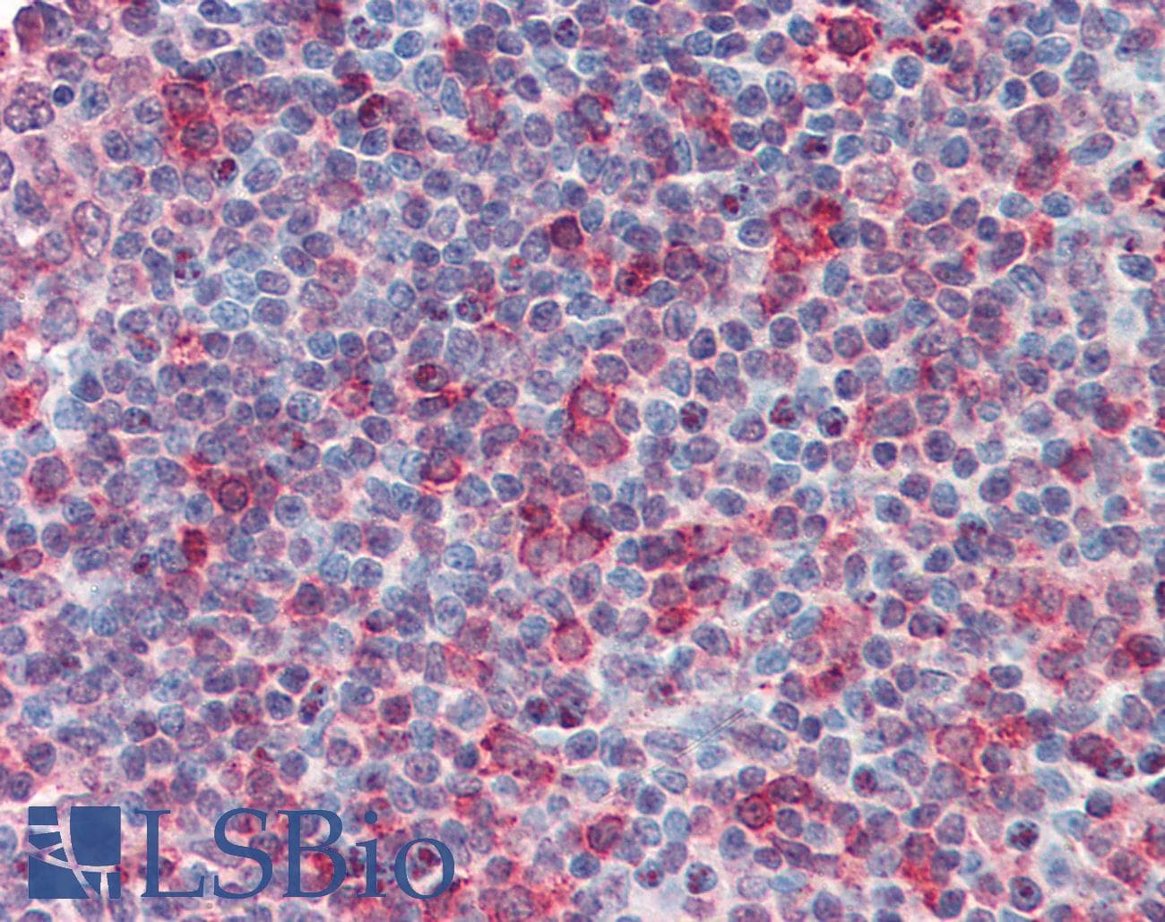 IHC-plus™ CD27L / CD70 Antibody (Internal)