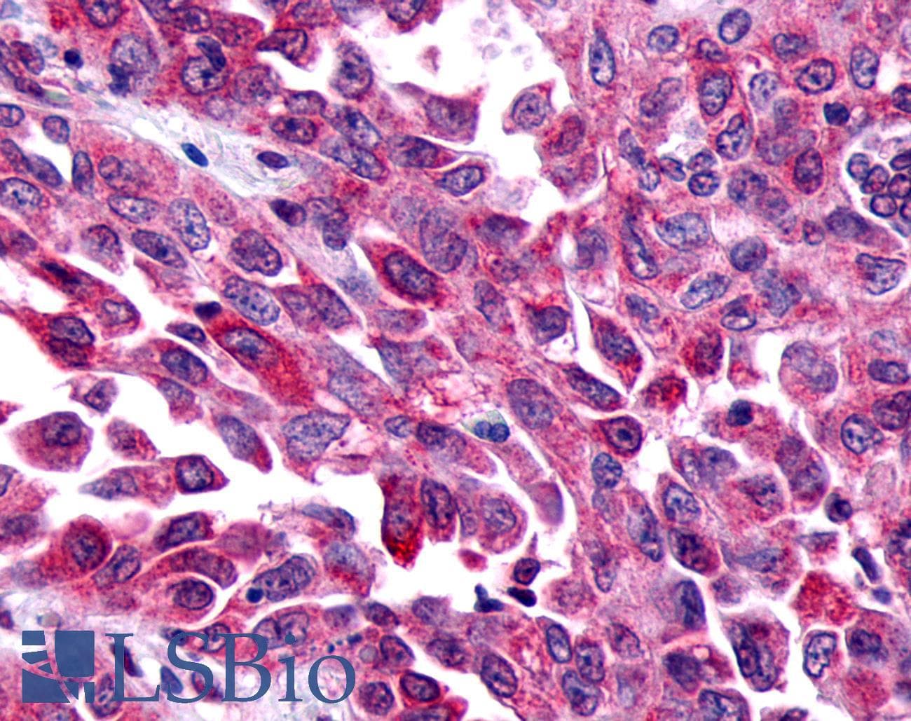 PathPlus™ FZD8 / Frizzled 8 Antibody (N-Terminus)