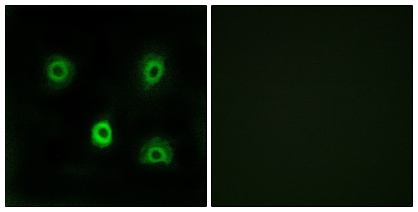 IHC-plus™ ABHD6 Antibody (aa231-280)