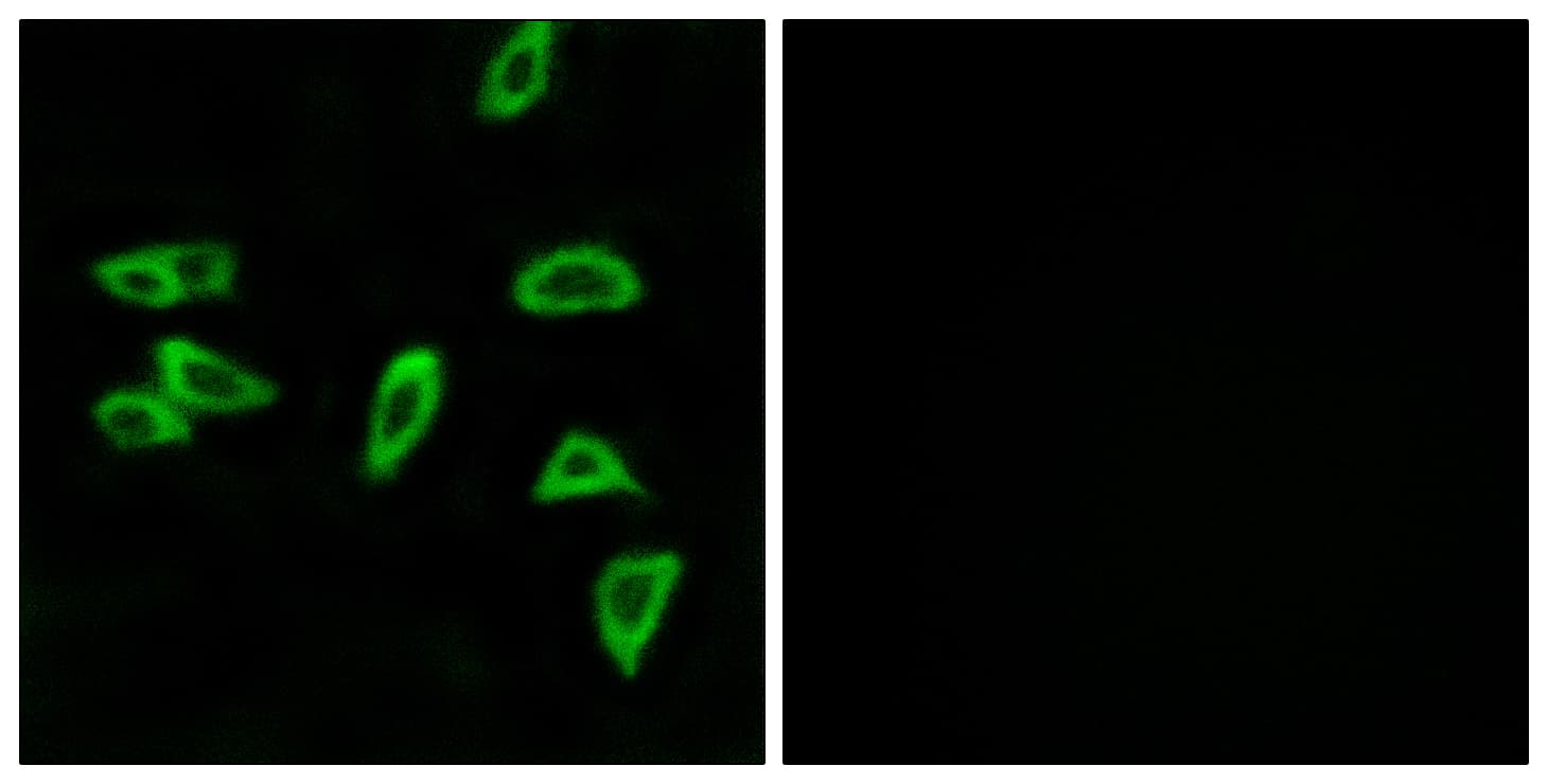 PTGER3 / EP3 Antibody (aa16-65)