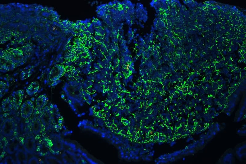 CD44 Antibody