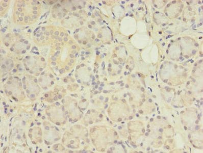 CENTB1 / ACAP1 Antibody