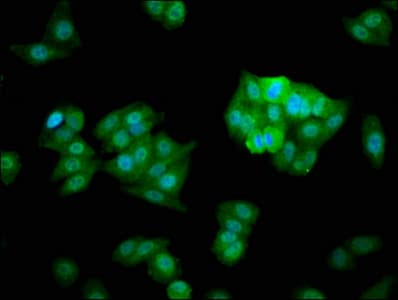 Vps60 / CHMP5 Antibody (aa1-219)