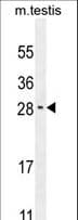 Polyclonal Rabbit anti-Human RELL2 Antibody (aa132-160, WB)
