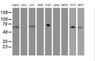 FBXO21 Antibody (clone OTI5H4)