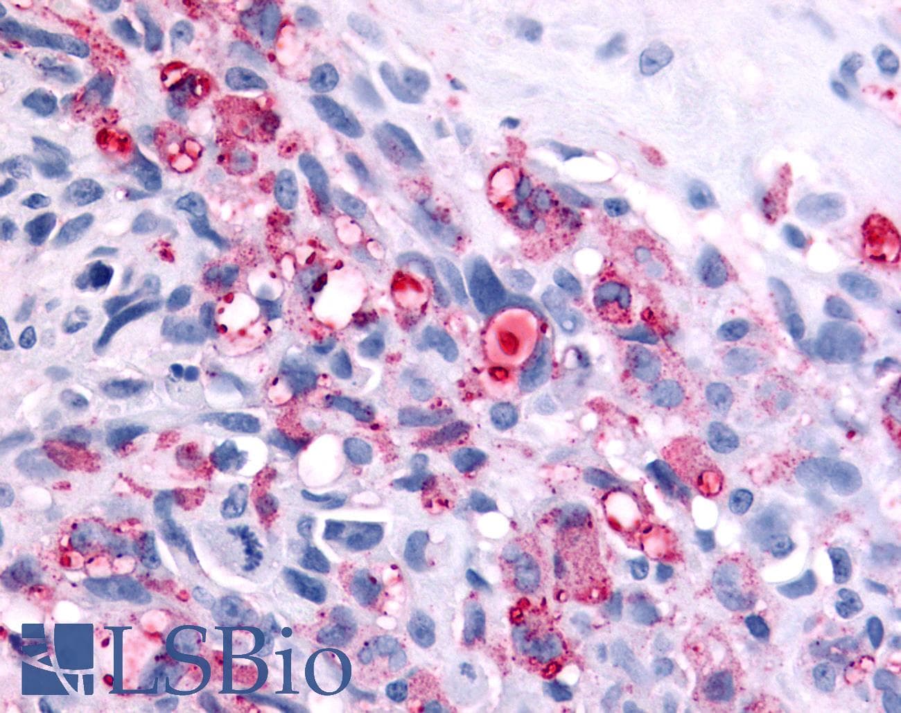 PathPlus™ Polyclonal Rabbit anti-Human ADGRB2 / BAI2 Antibody (C-Terminus, IHC)