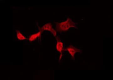 POTEB3 / POTE-15 Antibody