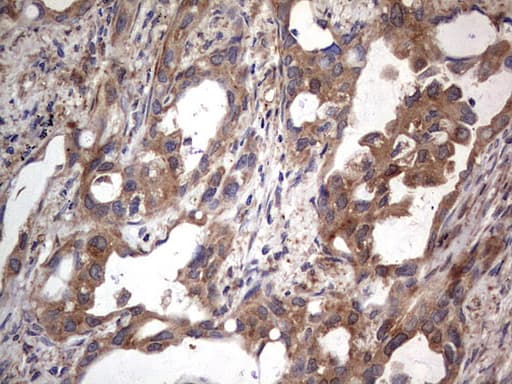 MTDH / Metadherin Antibody (aa70-582, clone OTI2F11)