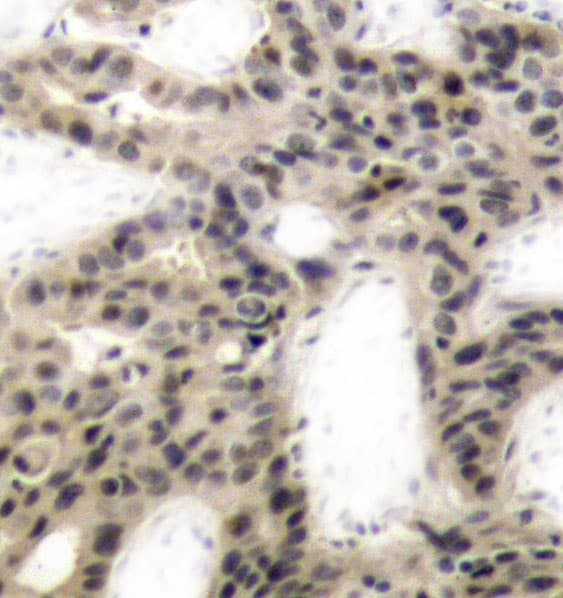 EIF4EBP1 / 4EBP1 Antibody (phospho-Thr45)