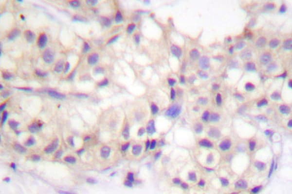Polyclonal Rabbit anti-Human PRKCA / PKC-Alpha Antibody (Gly633, IHC, WB)