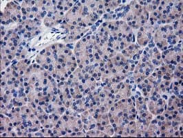 KATNAL1 Antibody (clone OTI6A4)