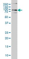 HHIP / HIP Antibody (clone 5D11)