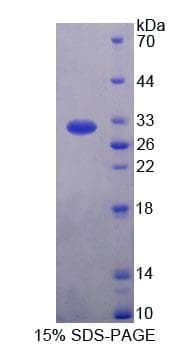 Rat RTKN / Rhotekin Protein (Recombinant His-T7)