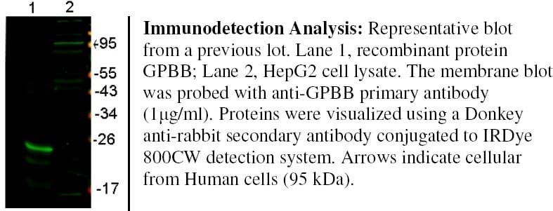 Polyclonal Rabbit anti-Human GPBB / PYGB Antibody (Preservative Free, WB)