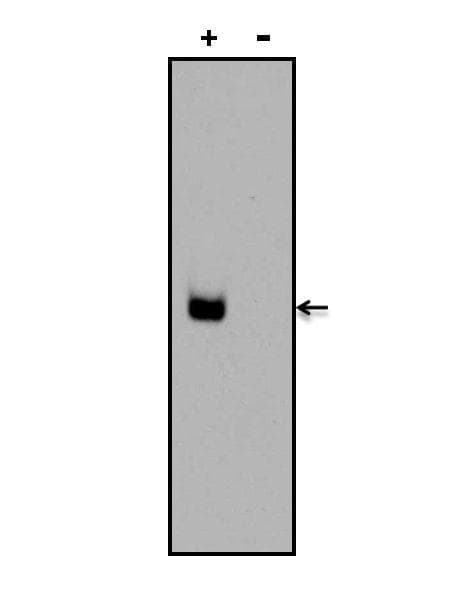Digoxin Antibody (clone 25P1C9)