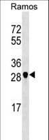 NOSIP Antibody (aa67-95)