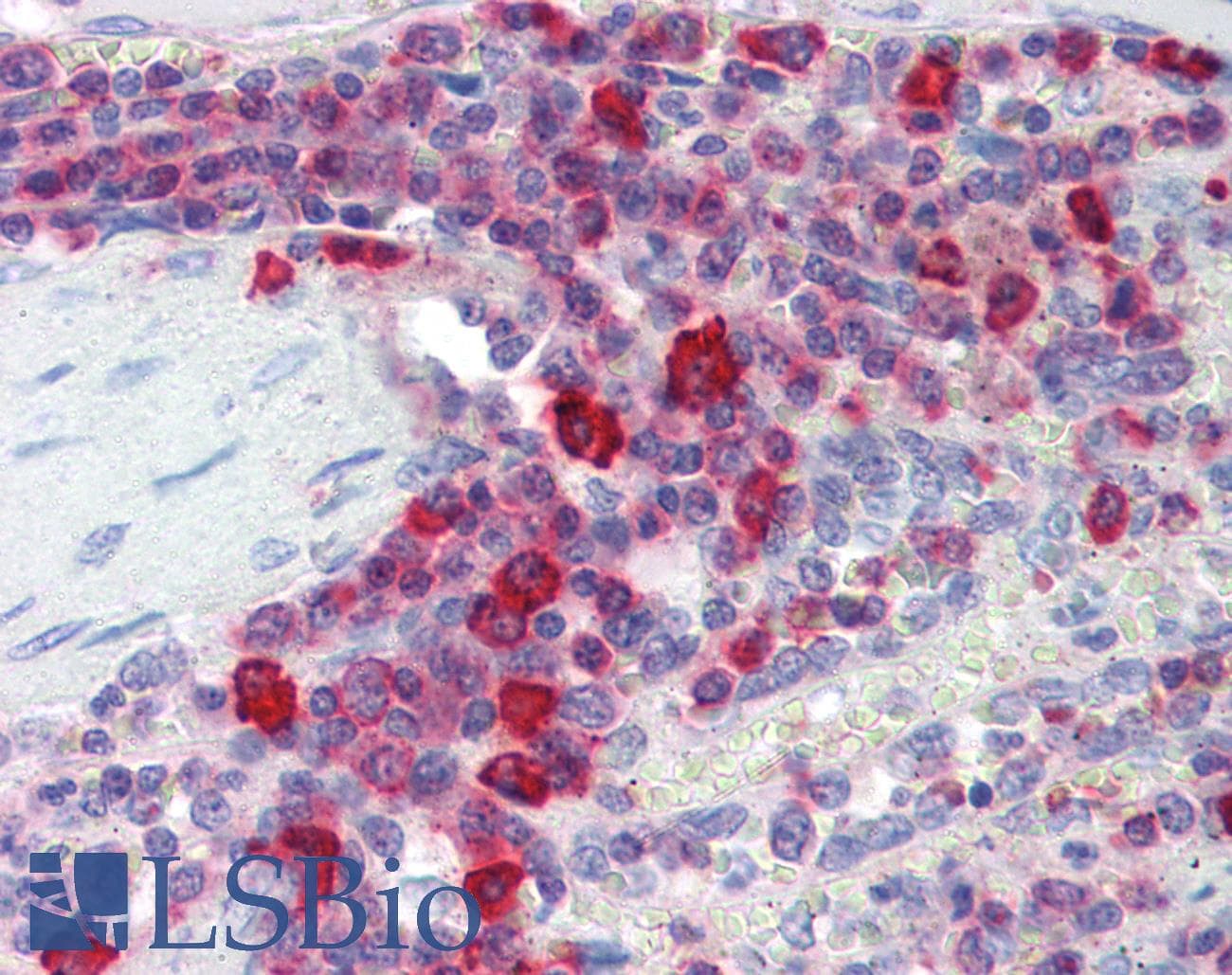 IHC-plus™ PIM3 / PIM-3 Antibody (aa259-288)