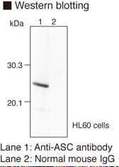 PYCARD / ASC / TMS1 Antibody (clone 23-4)