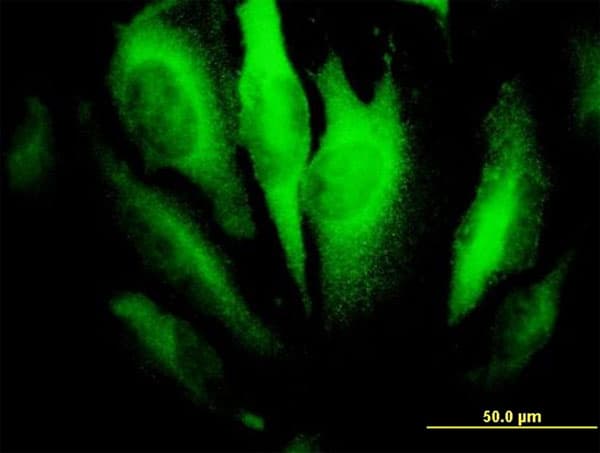 IHC-plus™ Monoclonal Mouse anti-Human RHOA Antibody (clone 1B12, IHC, IF, WB)