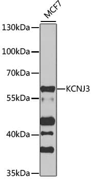 KCNJ3 / GIRK1 Antibody