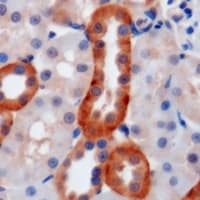 Polyclonal Rabbit anti-Human GYPA / CD235a / Glycophorin A Antibody (Internal, IHC, WB)