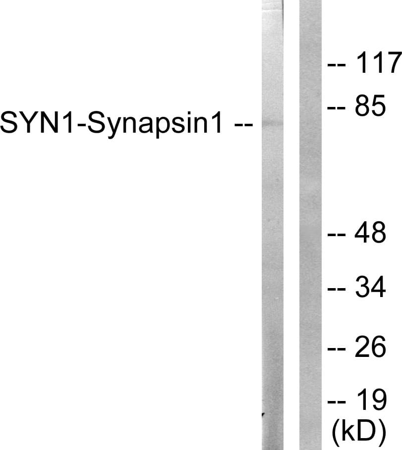 Polyclonal Rabbit anti-Human SYN1 / Synapsin 1 Antibody (aa26-75, IHC, WB)