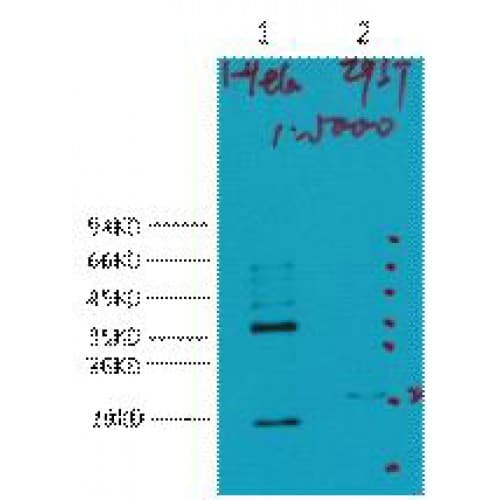 CA9 / Carbonic Anhydrase IX Antibody (clone 12F10)