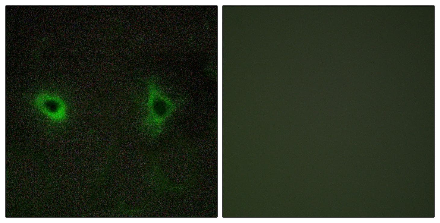 COL4A3 / Tumstatin Antibody